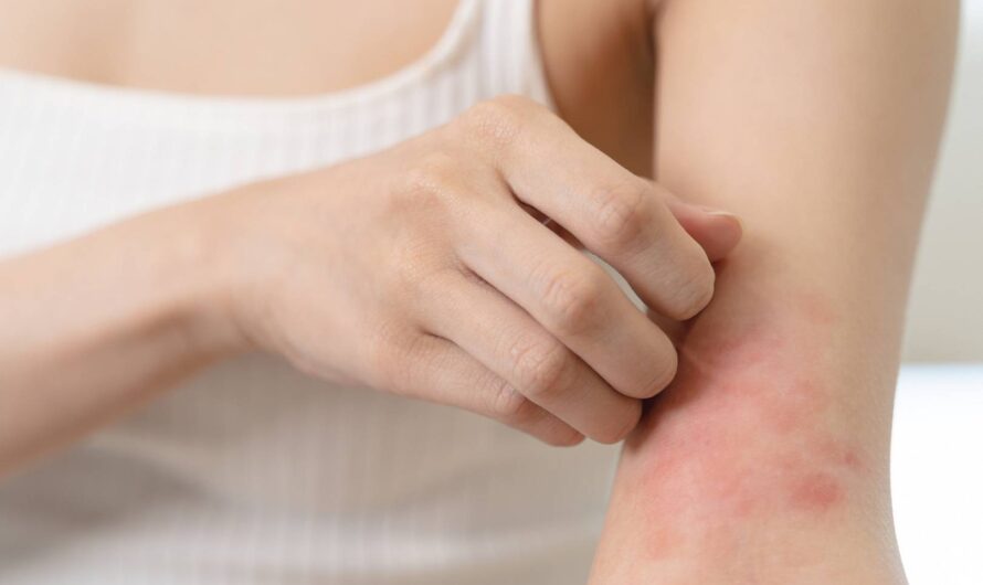 Atopowe zapalenie skóry: 5 najważniejszych zasad pielęgnacji skóry atopowej